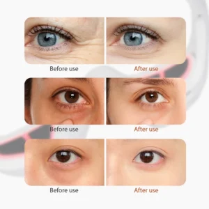 Red Eye Massager Under-Eye Massager Relieves Eye Fatigue - Thumbnail Image 9